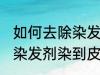 如何去除染发剂染在皮肤上的颜色 被染发剂染到皮肤如何处理